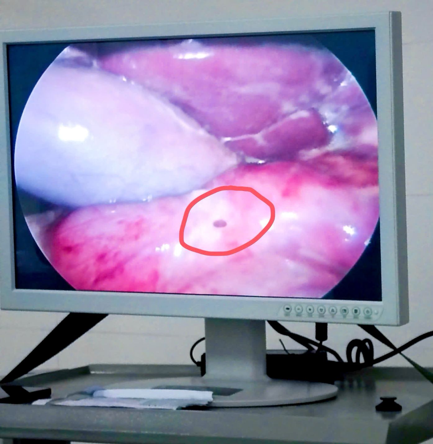 tangphauthuat2223333xxx