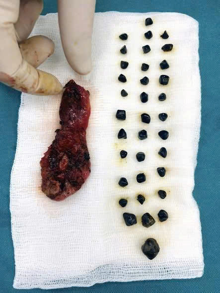 z7193776344858 44f5615ae55b1914b8774d7a21595b62