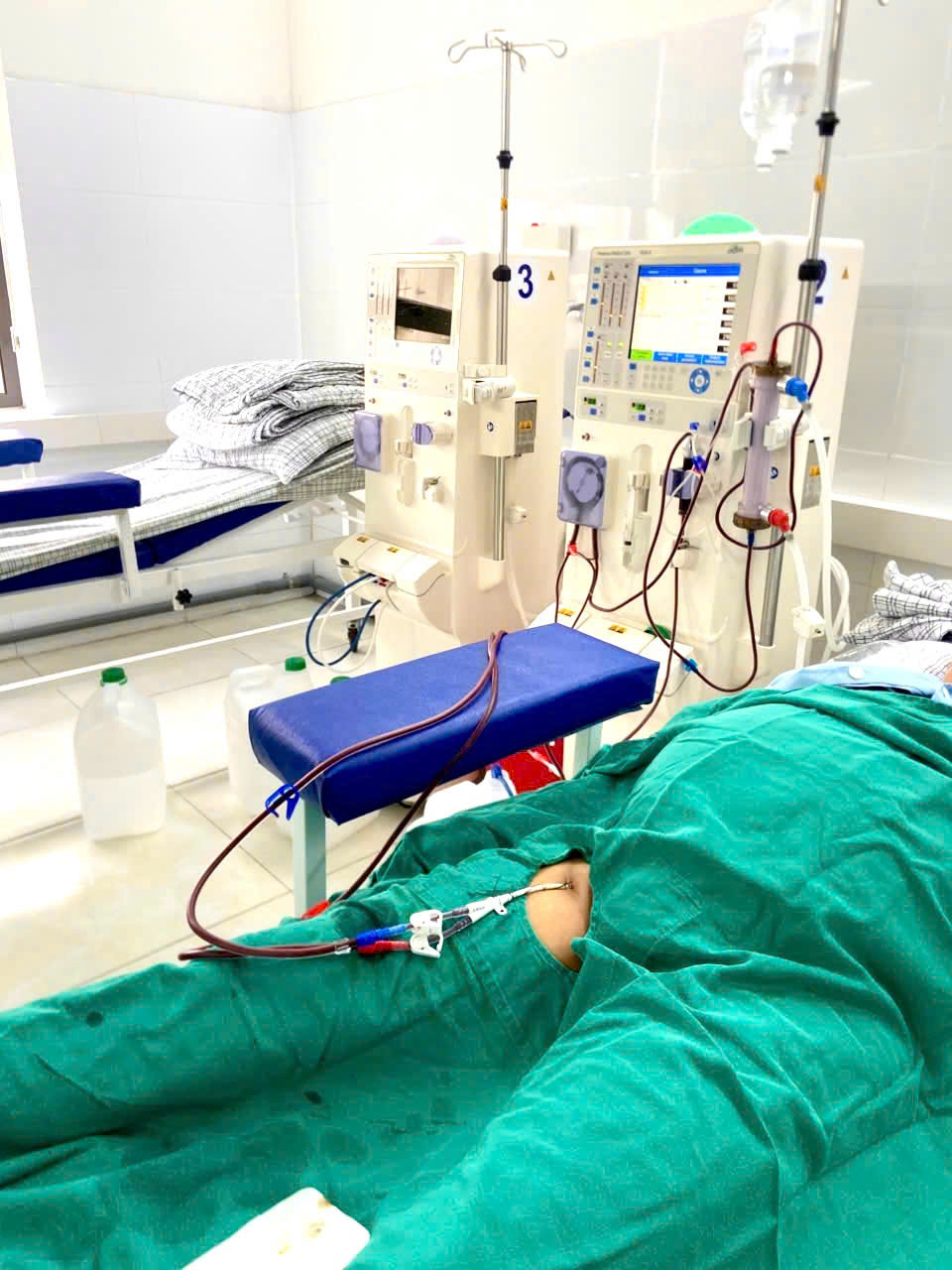 Lọc máu cấp cứu 3